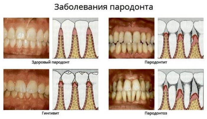 image2 image2